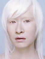 chinese_asian_albino_girl1.jpg chinese_asian_albino_girl1.jpg